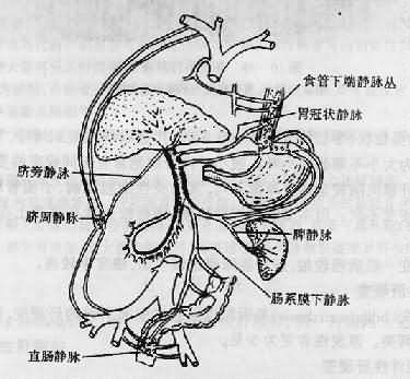 代償期肝硬化