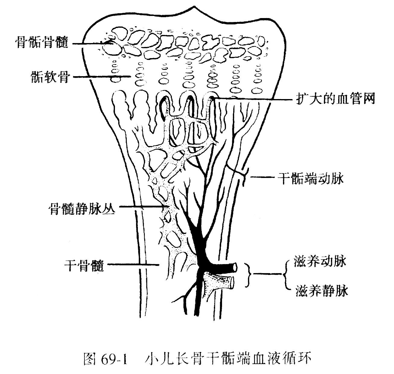 化膿性骨髓炎