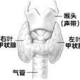 甲狀腺結節鈣化