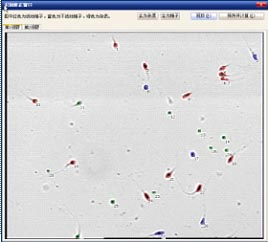 精子質量分析儀