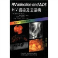 HIV感染及愛滋病