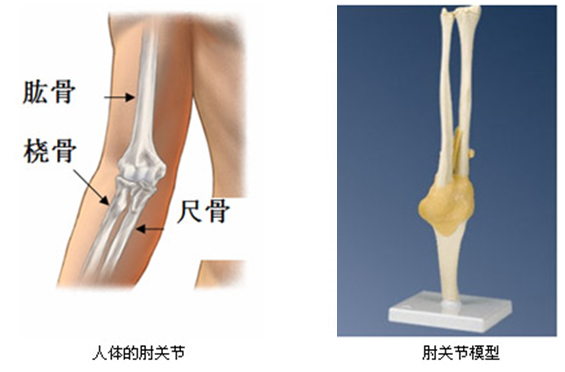 人工肘關節