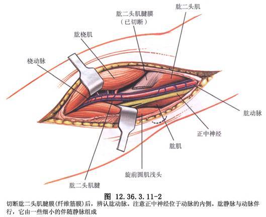 尺側腕屈肌移位術