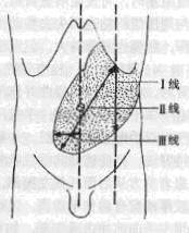 脾臟腫大