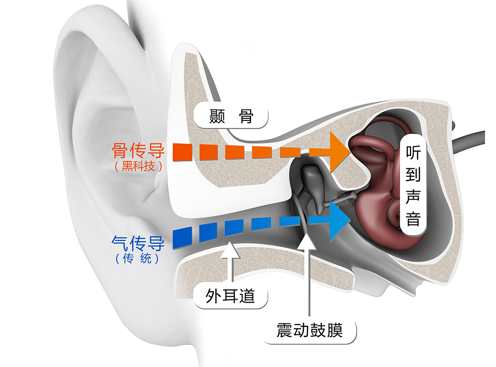 韶音