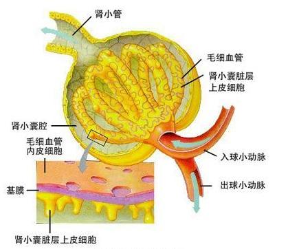 血管球