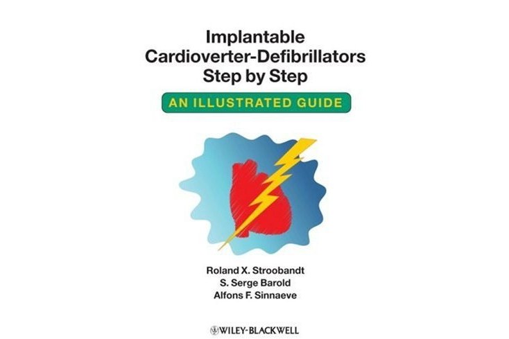 Implantable Cardioverter - Defibrillators Step by Step