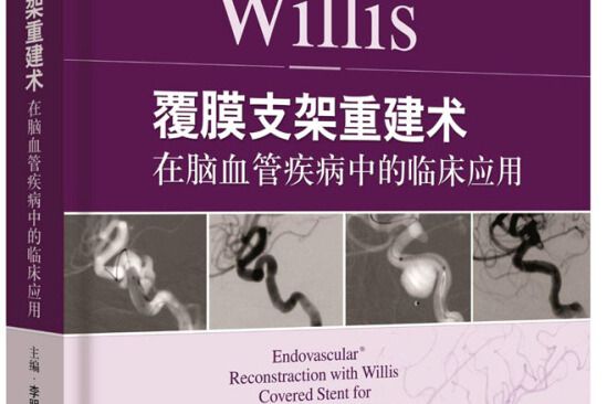 Willis覆膜支架重建術在腦血管疾病中的臨床套用