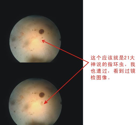 合江指環蟲