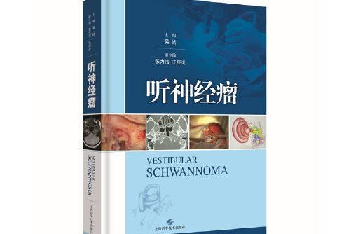 聽神經瘤(2018年上海科學技術出版社出版的圖書)