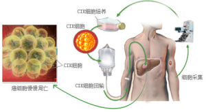 CLS生物免疫治療技術