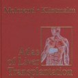 肝移植圖譜Atlas of Liver Transplantation