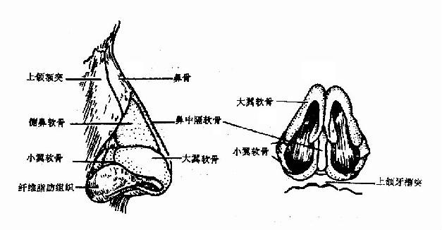 鼻小柱整形手術