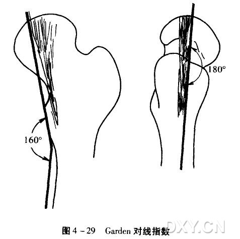 garden對線指數