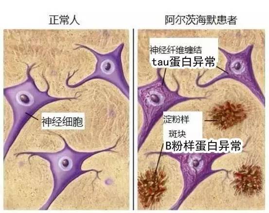 tau蛋白