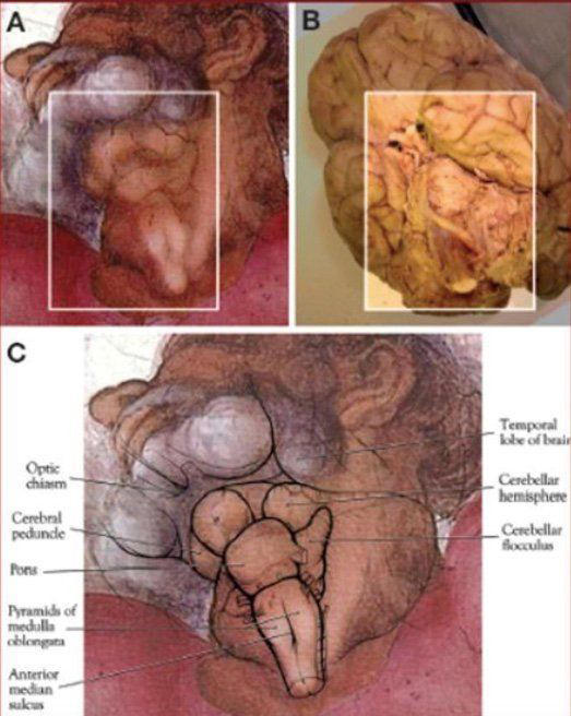 上帝的脖子(A)，紋理與大腦解剖圖(B)