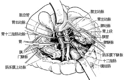 乏特氏壺腹周圍癌