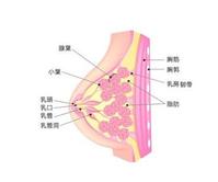 乳腺癌病理圖