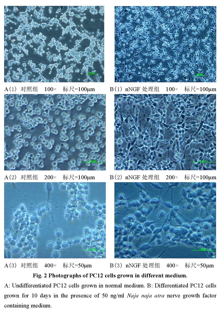 眼鏡蛇毒NGF對PC12細胞生長形態的影響