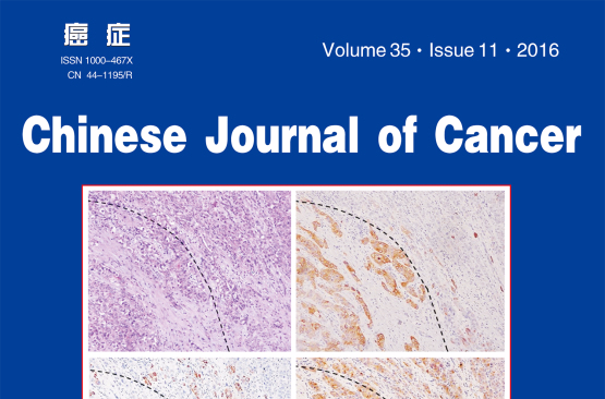 Chinese Journal of Cancer