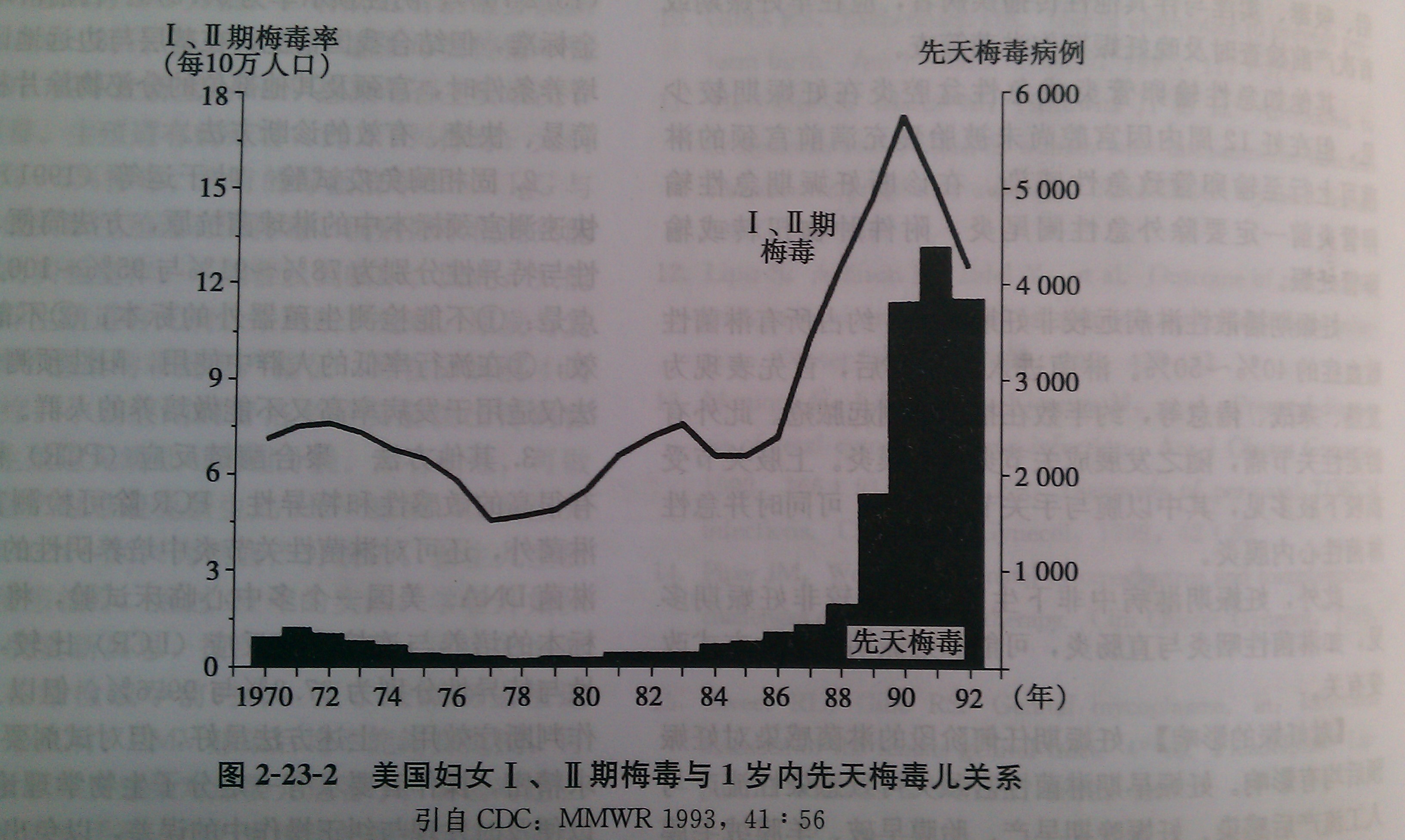 妊娠合併梅毒