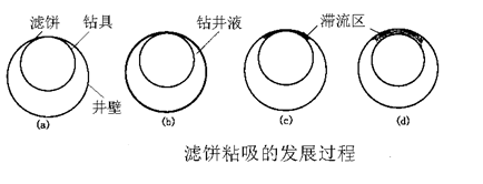 壓差卡鑽