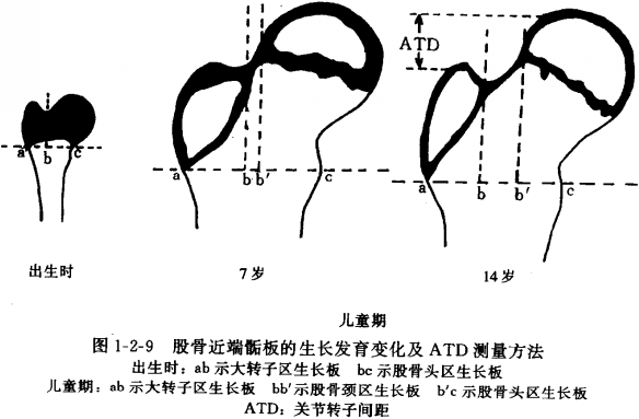 下肢全長