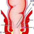 肛管括約肌橫斷