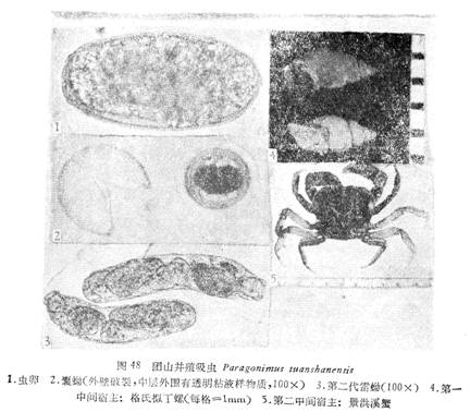 團山並殖吸蟲