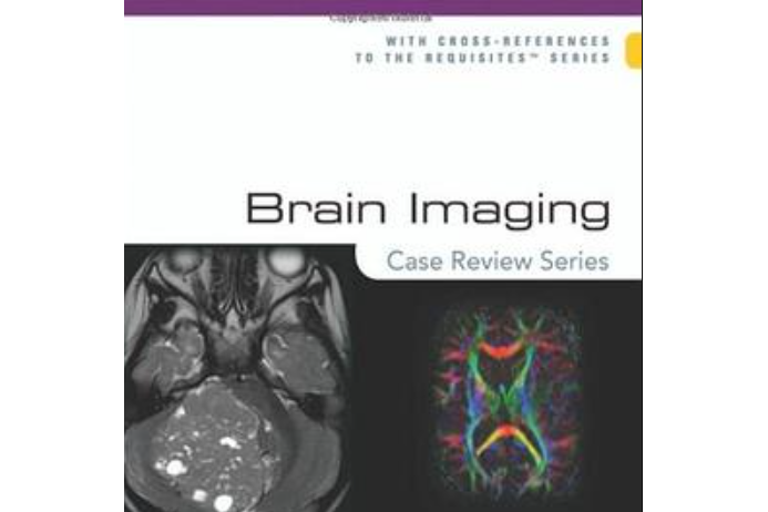 Brain Imaging