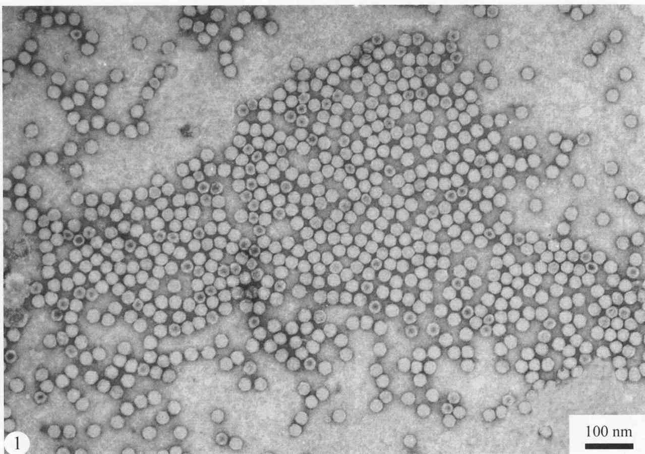 提純的蠶豆萎蔫病毒2號，2%磷鎢酸染色