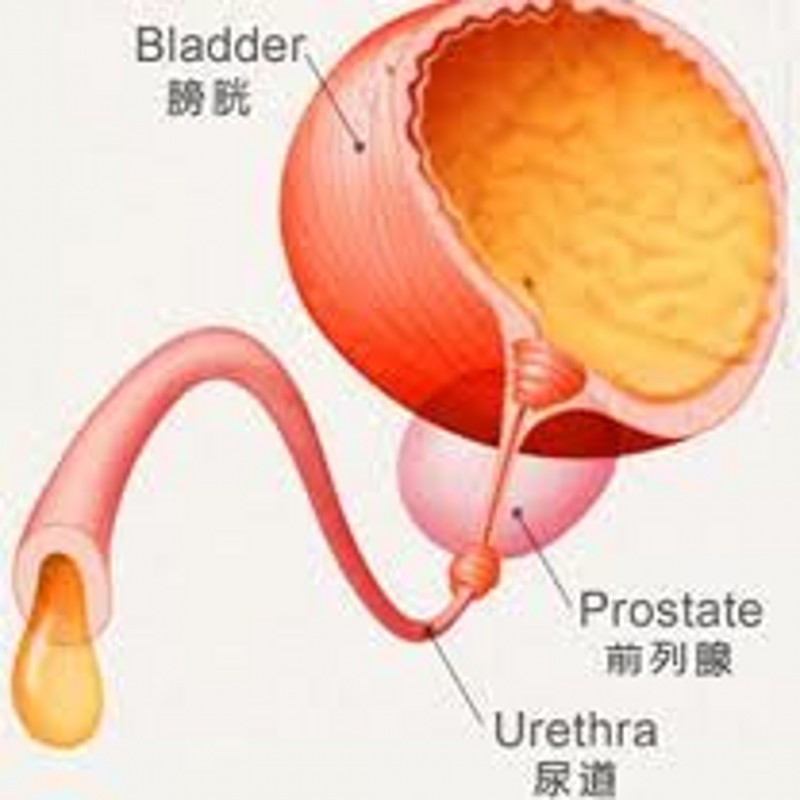 膀胱類型