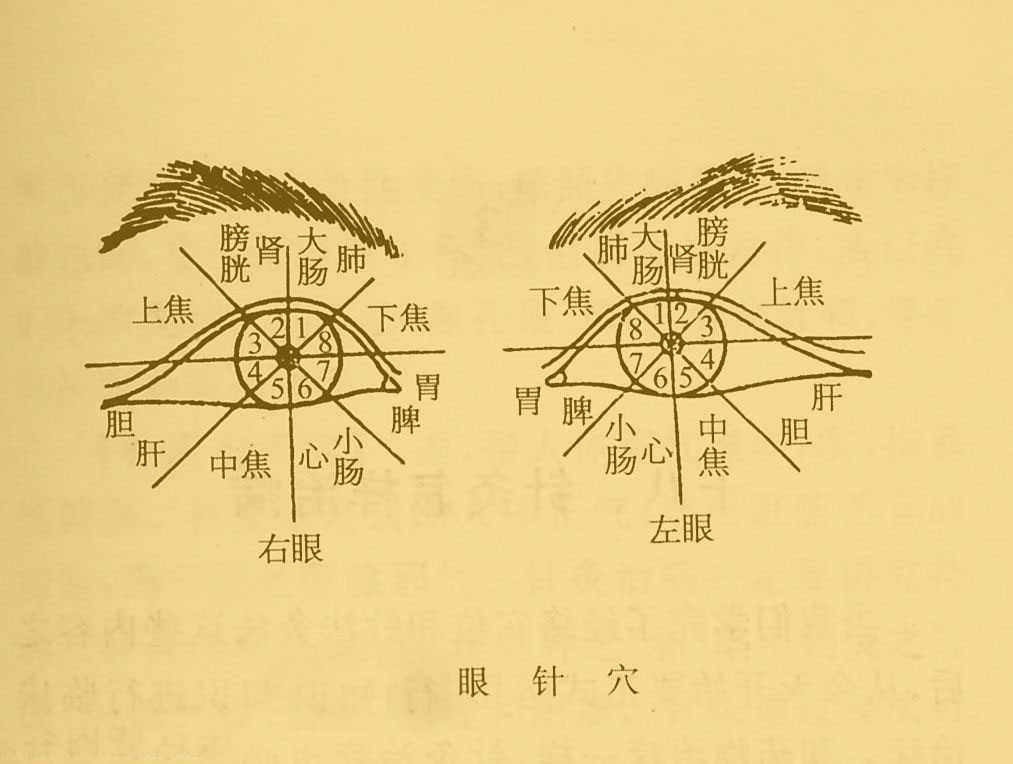 眼針法