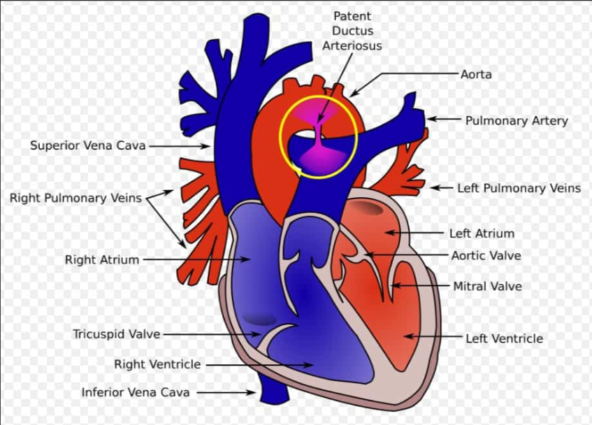 動脈導管