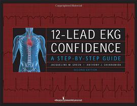 12- Lead EKG Confidence