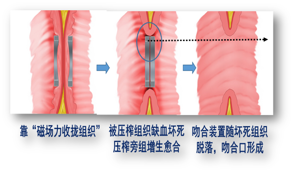 磁壓榨技術