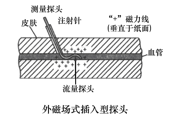 電磁血流量計