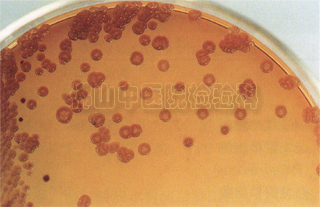 培養皿中的單胞均屬
