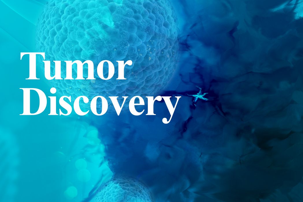 Tumor Discovery