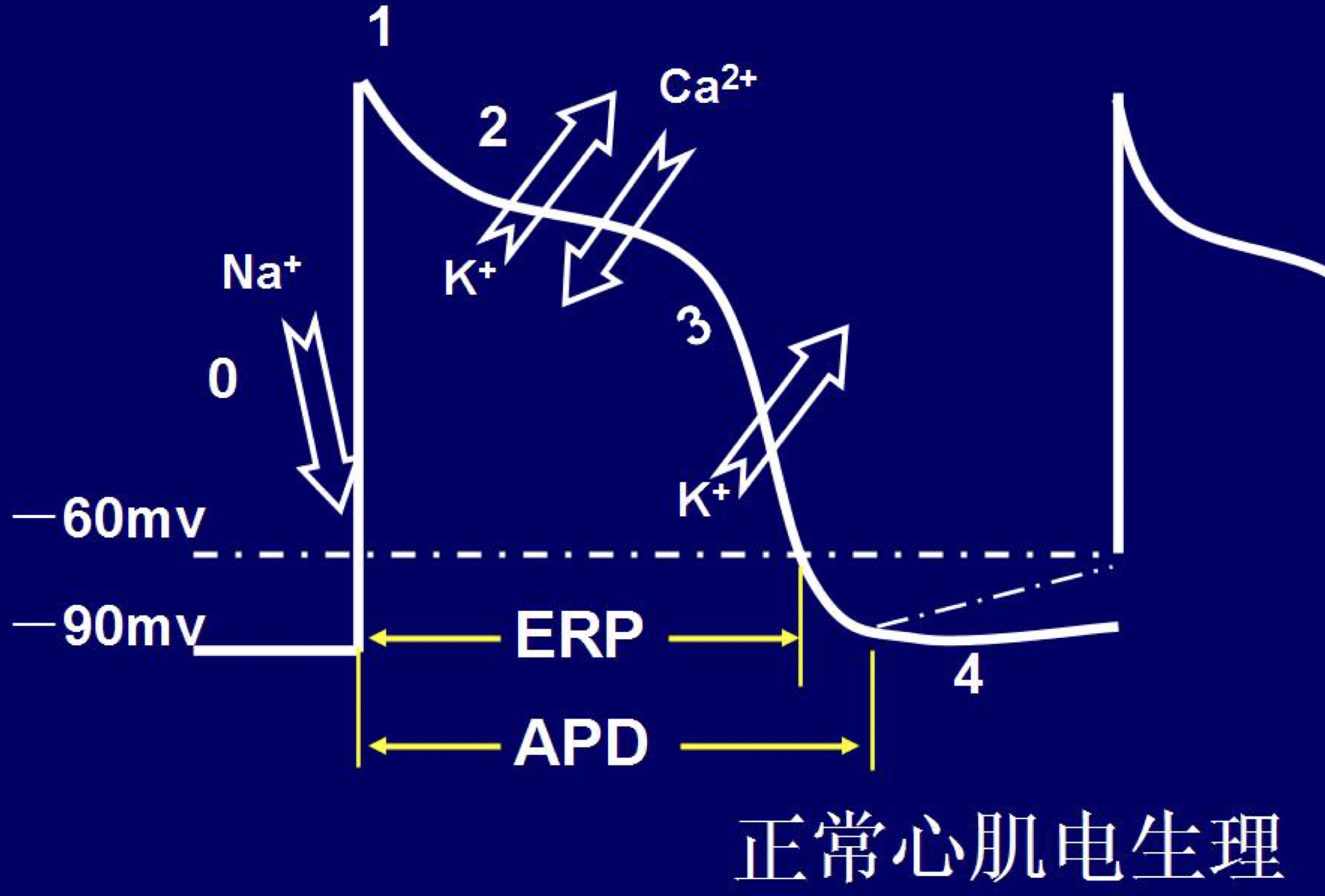 ERP(有效不應期)