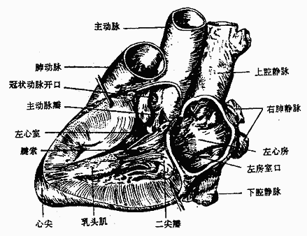 竇特發性室性心動過速