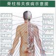 脊柱相關疾病示意圖