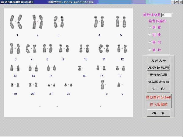 染色體分析系統