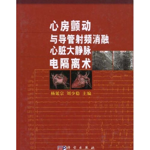 心房顫動與導管射頻消融心臟大靜脈電隔離術