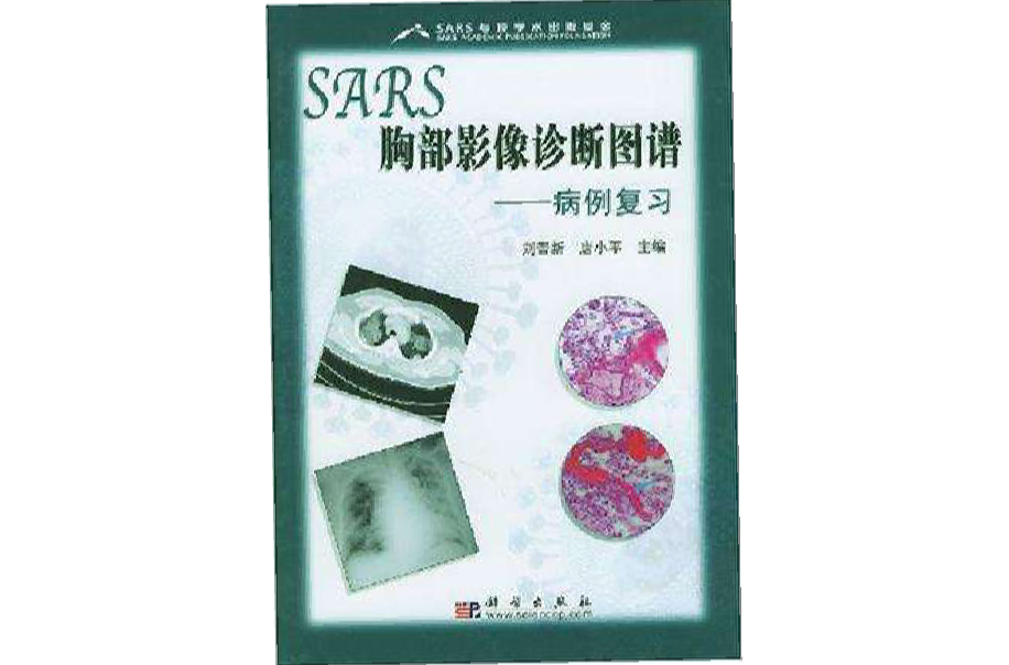 SARS胸部影像診斷圖譜