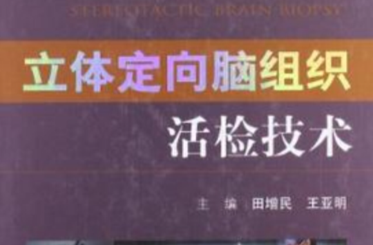 立體定向腦組織活檢技術