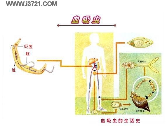 血吸蟲性肝病