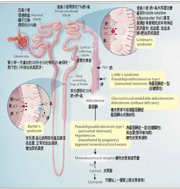 假性醛固酮症