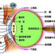 晶狀體抗原性葡萄膜炎