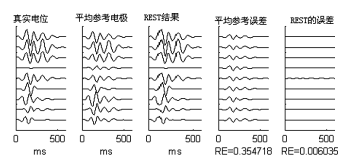 腦電記錄的零參考